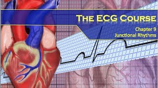 The ECG Course  Junctional Rhythms [upl. by Kirschner]