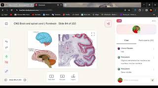 Telencephalon amp Diencephalon  Cerebral Cortex  lobs [upl. by Annenn]