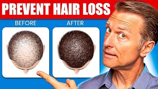 12 Proven Remedies to Prevent Hair Loss and Regrowth Regrow hair [upl. by Sheedy]