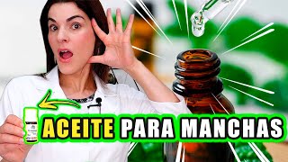 Utiliza este ACEITE para Aclarar cualquier MANCHA EN la Piel incluido el Melasma [upl. by Oicafinob985]