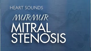 Mitral Stenosis Murmur  With Murmur Sounds Audio [upl. by Chin]