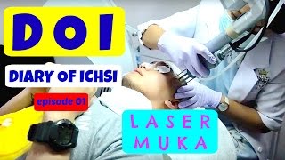 IchsanAkbarVlog 01  Laser Muka [upl. by Bronwyn736]