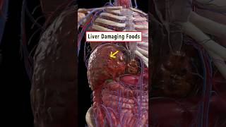 5 Foods Damaging Your Liver ☠️  health liver wellness healthtips shorts [upl. by Muslim]