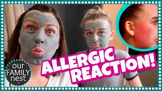 ALLERGIC REACTION TO FACIAL MASK [upl. by Freyah]