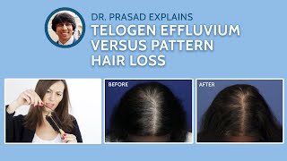 Differences Between Telogen Effluvium and Genetic Pattern Hair Loss [upl. by Brigit]