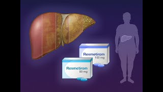 Resmetirom for NASH with Liver Fibrosis  NEJM [upl. by Netsreik316]