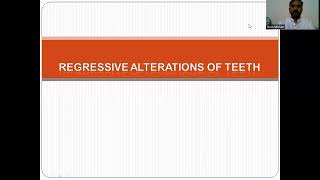 REGRESSIVE ALTERATIONS OF TEETHDR ARUN MOHAN DEPT OF ORAL AND MAXILLOFACIAL PATHOLOGY RDC [upl. by Eninahs]