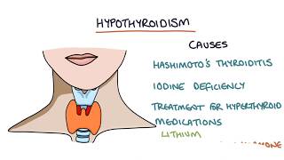 Hypothyroidism and Hashimotos Thyroiditis Visual Explanation for Students [upl. by Trilly]