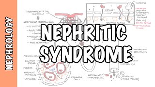 Nephritic Syndrome  classification pathophysiology treatment RPGN ANCA Immune complex [upl. by Ojybbob407]