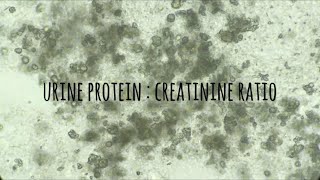 Urine protein creatinine ratio [upl. by Vladimar]