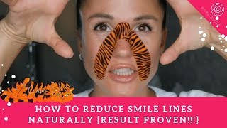 How to Get Rid of Smile Lines Face Yoga  Kinesio Tape [upl. by Nemzzaj]