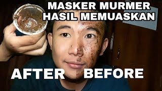 MASKER KOMEDO MURMER CABUT SEMUA KOMEDOO SAKITT TAPI PUASS LIHAT HASILNYA [upl. by Sanburn]