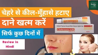 Neoclobenate Gm Cream Review in Hindi । HealthyBro। [upl. by Chryste]