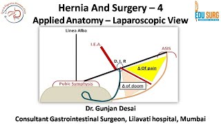 Mastering Hernia Surgery  4 Applied anatomy for Laparoscopic Inguinal hernia  Edusurg Clinics [upl. by Ocire]