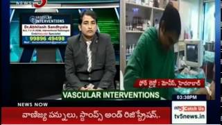 Laser Treatment for Varicose Veins  Health File  TV5 News [upl. by Rabin407]