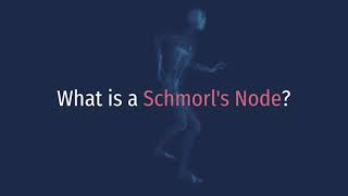 What is a Schmorls Node Schmorls Node Definition [upl. by Waterer72]