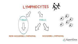 T Cell Lymphoma [upl. by Nipsirc]