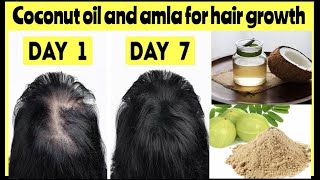 coconut oil and amla powder for hair growth amla powder for hair growthmixing amla and coconut oil [upl. by Ormond660]