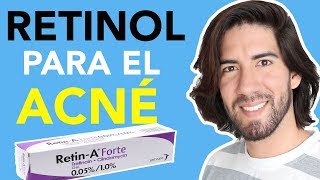 MI EXPERIENCIA CON EL RETINOL PARA ACNÉ Y CICATRICES  JM Montaño [upl. by Isleana]