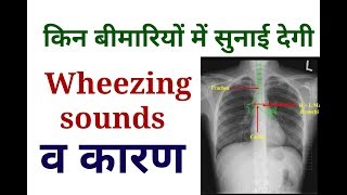 Wheezing Sounds  Causes OF wheezing Sounds  Lungs Examination [upl. by Sig]