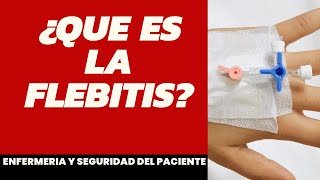 ¿Que es la flebitis enfermería [upl. by Ymiaj]