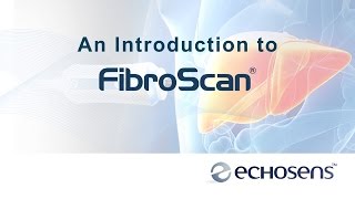 A Patients Introduction to FibroScan [upl. by Yehtomit99]