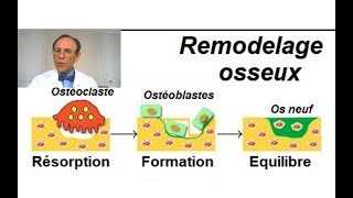 Ostéoporose amp Ostéopénie vertébrales  Traitement naturel sans médicament [upl. by Alded]