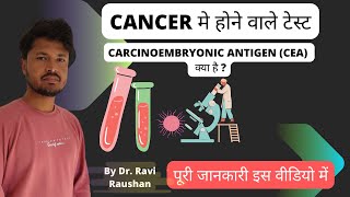 Carcinoembryonic antigen CEA क्या है [upl. by Sirtemed465]