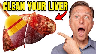 Top BEST Foods to Clean Out Your Liver [upl. by Isus274]