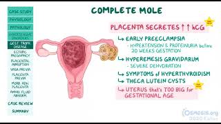 OSMOSIS Ectopic pregnancy Gestational Hypertension placental abruptions Troph disease 🔥🔥 [upl. by Eeuqram]