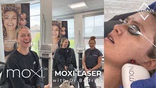 Moxi Laser Treatment with Dr Bedrick amp MJ Snyder [upl. by Nileuqcaj]