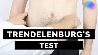 Trendelenburgs Test  OSCE Guide  Clip  UKMLA  CPSA [upl. by Sillsby352]