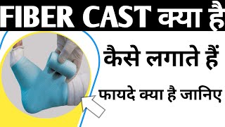 Fiber Cast Application And its Benefits  फाइबर कास्ट क्या है और इसको कैसे लगाया जाता है plaster [upl. by Aitnahs]