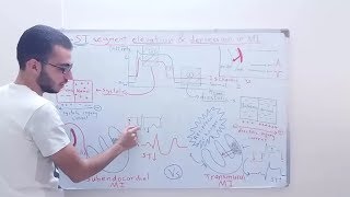 شرح آلية تزحل الوصلة الشدفة ST للأعلى وللأسفل ST Elevation amp ST depression [upl. by Donica]