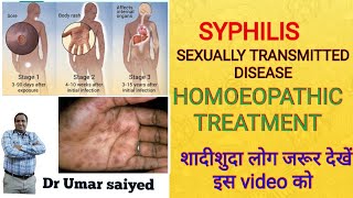 SYPHILIS HOMOEOPATHIC TREATMENT [upl. by Vivie202]