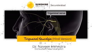 Trigeminal Neuralgia Hindi  Dr Naveen Mehrotra  Neurosurgeon  Sunshine Hospitals [upl. by Eniotna]