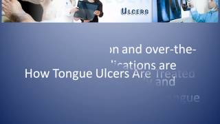 What Causes Ulcers on Tongue and How to Treat It [upl. by Perron]