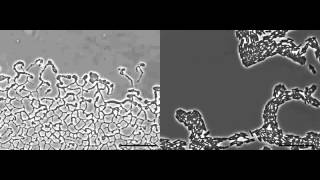 Pseudomonas aeruginosa biofilm expansion via twitching motility [upl. by Etnoved]