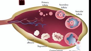 What Causes Ovarian Torsion  Symptoms Causes And Treatment 3D Animation [upl. by Pickar]