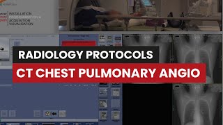 Pulmonary Angiography CT Protocol A Guide for Rad Techs [upl. by Adnilec732]