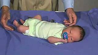 physical exam Newborn Normal Tone  Resting Posture [upl. by Sheffie314]