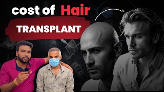 Cost of Hair transplant  Naku subscriber antha pay chesadu [upl. by Anaitsirk38]