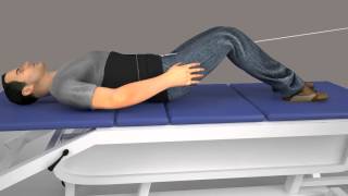 Lumbar Decompression Animation [upl. by Trenton]