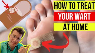 Doctor explains how to treat WARTS at home plus when to seek medical attention [upl. by Fabien]