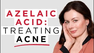 Azelaic Acid 5 Reasons To Use Azelaic Acid In Acne  Dr Sam Bunting [upl. by Cleopatre]