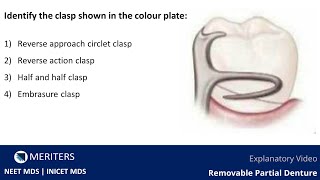 NEET MDS  INICET  Prostho  Removable Partial Denture  Explanatory Video  MERITERS [upl. by Bertelli]