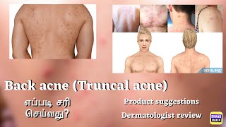 Is Body Acne your problem Products for Body Back Acne எப்படி சரி செய்வது drthamizhinian [upl. by Staffan144]