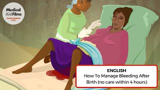 How to manage bleeding after birth no care within 4 hours [upl. by Nasho]