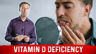 Vitamin D Deficiency Effects on Your Teeth – DrBerg [upl. by Adlanor959]