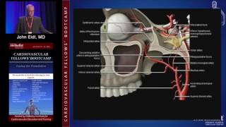 Neurovascular Anatomy Physiology and Carotid Imaging John Eidt MD [upl. by Hadeehuat]